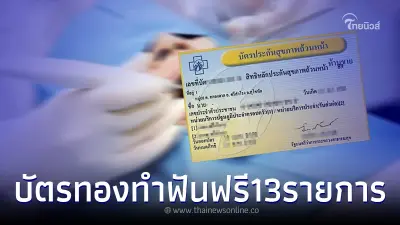 "ทำฟันฟรี 13 รายการ" สำหรับผู้ใช้บัตรทอง เช็คเลยมีอะไรบ้าง "ทำฟันฟรี 13 รายการ" สำหรับผู้ใช้บัตรทอง เช็คเลยมีอะไรบ้าง