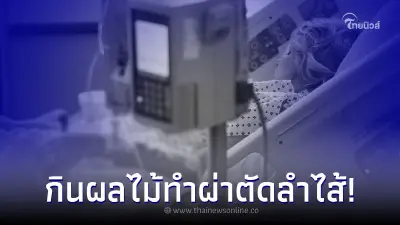 สาวใหญ่ปวดท้อง - คลื่นไส้ ตรวจเจอลำไส้อุดตันต้องผ่าตัด รู้สาเหตุยิ่งแปลกใจ สาวใหญ่ปวดท้อง - คลื่นไส้ ตรวจเจอลำไส้อุดตันต้องผ่าตัด รู้สาเหตุยิ่งแปลกใจ