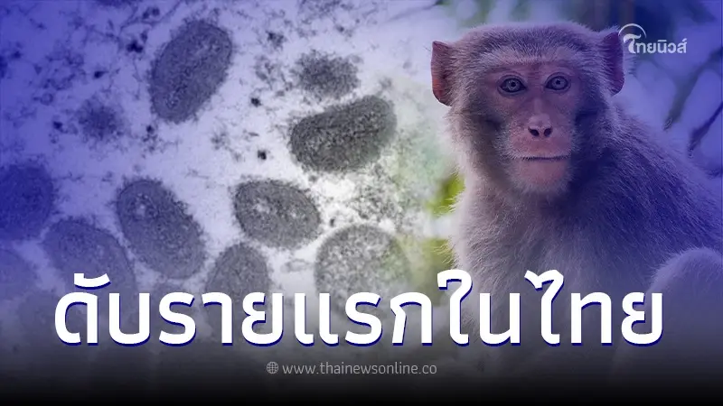 ผู้ป่วยฝีดาษลิงเพศชาย เสียชีวิตรายแรกในไทย พบป่วยโรคอื่นด้วย ผู้ป่วยฝีดาษลิงเพศชาย เสียชีวิตรายแรกในไทย พบป่วยโรคอื่นด้วย