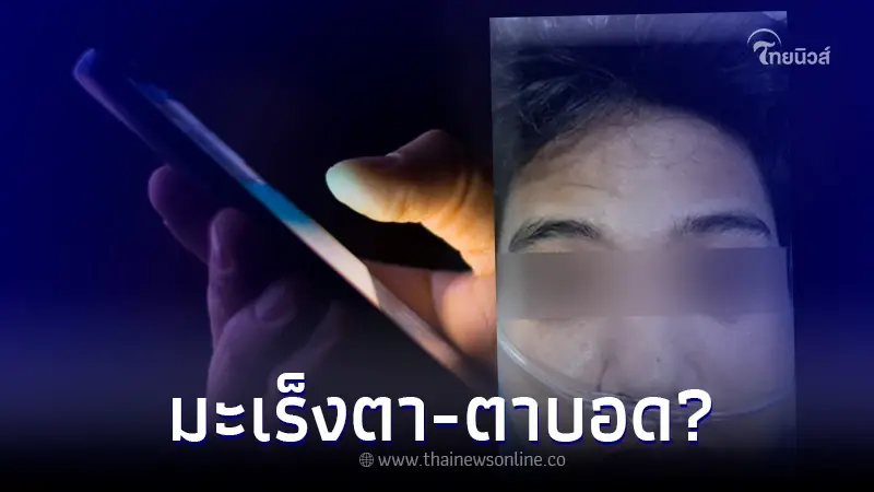 เล่นมือถือในที่มืดนาน ทำให้เป็นมะเร็งตา ตาบอดถาวร สถาบันมะเร็งฯ แจงแล้ว