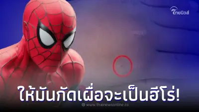 หนุ่มน้อย 8 ขวบ แหย่ให้แมงมุมแม่ม่ายดำกัด เพราะอยากเป็นสไปเดอร์แมน หนุ่มน้อย 8 ขวบ แหย่ให้แมงมุมแม่ม่ายดำกัด เพราะอยากเป็นสไปเดอร์แมน