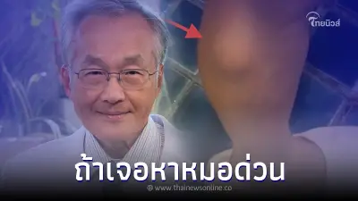 "หมอมนูญ" เปิดเคส มะเร็งเนื้อเยื่อเกี่ยวพัน พบก้อนที่ขาหาหมอด่วน ก่อนสาย