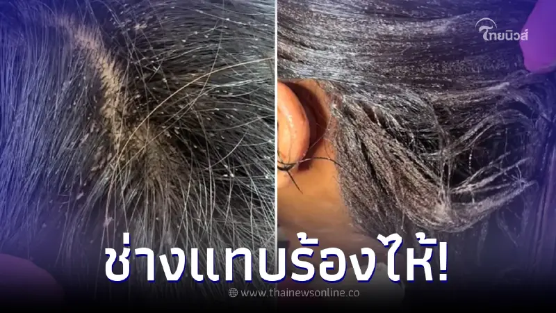 ช่างสยอง เด็กหญิงขอให้ช่วย หลังเหาไต่เต็มหัว เห็นสภาพแทบร้องไห้ ช่างสยอง เด็กหญิงขอให้ช่วย หลังเหาไต่เต็มหัว เห็นสภาพแทบร้องไห้