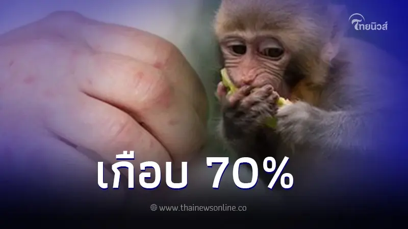 พบผู้ติดเชื้อ"โรคฝีดาษวานร"ต่อเนื่องในไทย เกือบ 70 % ติดเอชไอวีร่วมด้วย พบผู้ติดเชื้อ"โรคฝีดาษวานร"ต่อเนื่องในไทย เกือบ 70 % ติดเอชไอวีร่วมด้วย