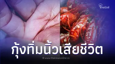 ชายโดนกุ้งทิ่มนิ้ว แผลไม่ลึก ต่อมานิ้วบวมม่วง อาการทรุดเสียชีวิตใน 3 วัน ชายโดนกุ้งทิ่มนิ้ว แผลไม่ลึก ต่อมานิ้วบวมม่วง อาการทรุดเสียชีวิตใน 3 วัน