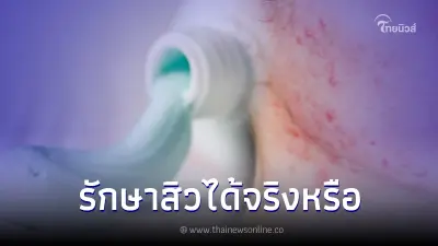 กระทรวงสาธารณสุข ตอบชัด การรักษาสิวด้วยยาสีฟัน ทำได้จริงหรือไม่