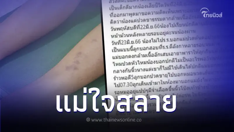 แม่โพสต์อุทาหรณ์ ลูกสาววัย 13 ปี ปวดขาหลังสอบวิชาพละ สุดท้ายเสียชีวิต แม่โพสต์อุทาหรณ์ ลูกสาววัย 13 ปี ปวดขาหลังสอบวิชาพละ สุดท้ายเสียชีวิต