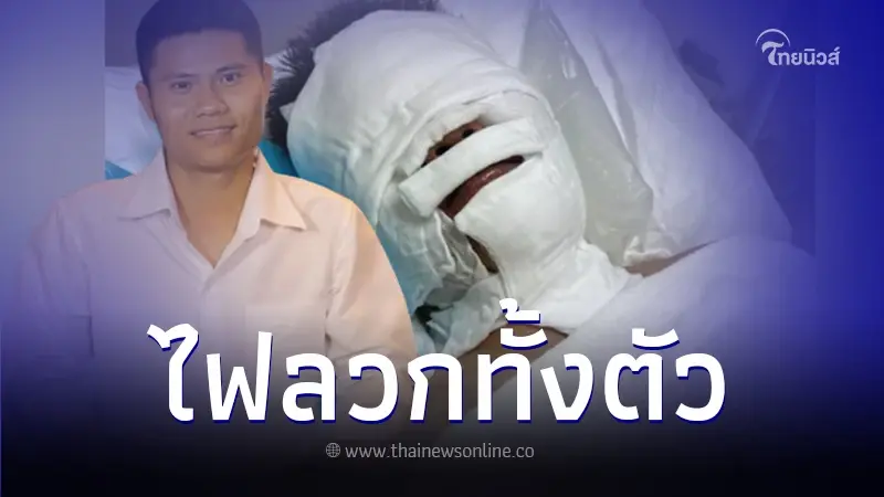 "อ.จินนี่ ภูไท" ถูกหามตัวส่ง รพ. ด่วน ถูกไฟลวกทั้งตัว "อ.จินนี่ ภูไท" ถูกหามตัวส่ง รพ. ด่วน ถูกไฟลวกทั้งตัว