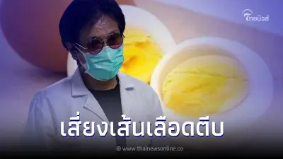 "หมอธีระวัฒน์" เผยข้อมูล คนที่ชอบกินไข่มาก ๆ ต้องอ่าน เสี่ยงเส้นเลือดตีบ