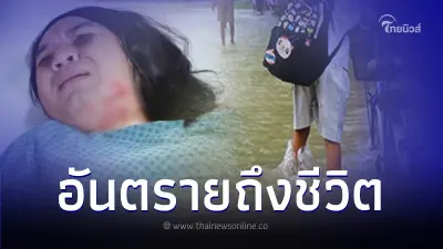"โรคเมลิออยด์" อันตรายถึงชีวิต "หมอแล็บแพนด้า" เตือน อย่าเหยียบย่ำน้ำสกปรก