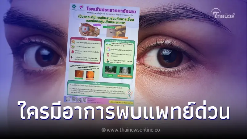 ไม่ใช่เรื่องเล่น ๆ เปิดอาการ เส้นประสาทตาอักเสบ ใครมี พบแพทย์ด่วน ไม่ใช่เรื่องเล่น ๆ เปิดอาการ เส้นประสาทตาอักเสบ ใครมี พบแพทย์ด่วน