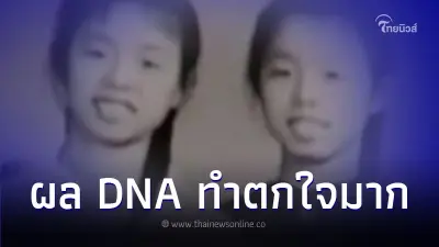 2 เพื่อนสนิท หน้าเหมือนกันมาก จนลองตรวจ DNA เล่นๆ แต่ผลที่ออกมาทำเซอร์ไพรส์