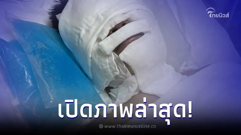 ภรรยาโพสต์ภาพล่าสุด "อ.จินนี่ ภูไท" นักแต่งเพลงชื่อดัง หลังโดนไฟคลอก ภรรยาโพสต์ภาพล่าสุด "อ.จินนี่ ภูไท" นักแต่งเพลงชื่อดัง หลังโดนไฟคลอก