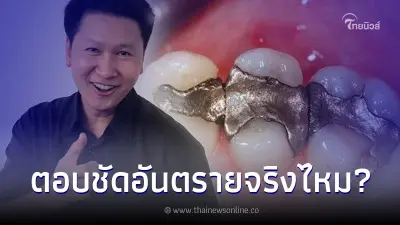 อ.เจษฎ์ เผยความจริง อุดฟันด้วยอะมัลกัมปรอท อันตรายต่อร่างกายจริงหรือไม่ อ.เจษฎ์ เผยความจริง อุดฟันด้วยอะมัลกัมปรอท อันตรายต่อร่างกายจริงหรือไม่