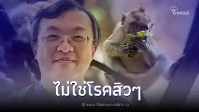 หมอธีระ เปิดประเด็นสำคัญ เกี่ยวกับ 'ฝีดาษลิง' งานนี้ไม่ใช่เรื่องสิวๆแล้ว หมอธีระ เปิดประเด็นสำคัญ เกี่ยวกับ 'ฝีดาษลิง' งานนี้ไม่ใช่เรื่องสิวๆแล้ว