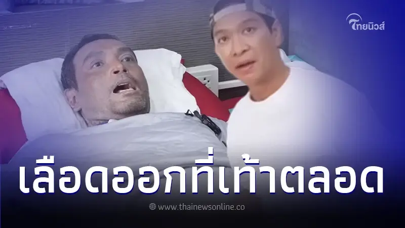 หนุ่ม คงกระพัน เห็นแล้วตกใจเท้า เมฆ วินัย ไกรบุตร ล่าสุดเดินลำบากหวั่นแผลปริ หนุ่ม คงกระพัน เห็นแล้วตกใจเท้า เมฆ วินัย ไกรบุตร ล่าสุดเดินลำบากหวั่นแผลปริ