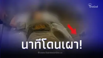 เน็ตไอดอล แฉนาที คลินิกดัง "เผายาหน้าท้อง" พอไฟลุกท่วม แต่หมอวิ่งหนี เน็ตไอดอล แฉนาที คลินิกดัง "เผายาหน้าท้อง" พอไฟลุกท่วม แต่หมอวิ่งหนี