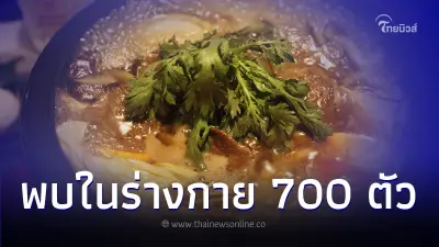 ชายชาวจีนกินชาบูหม่าล่าไม่กี่วันปวดศีรษะ - ลมชัก ตรวจพบพยาธิมากกว่า 700 ตัว