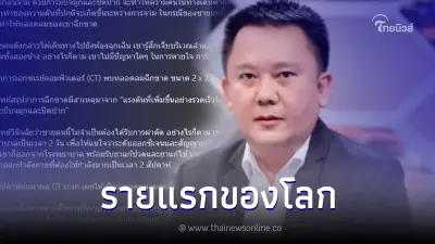 หมอเตือน ! พบแล้วรายแรกของโลก กลั้นจามจนหลอดลมฉีกขาด