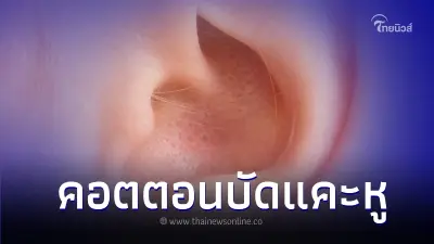 จริงหรือไม่? คอตตอนบัดแคะหูบ่อย ๆ เป็นอันตราย