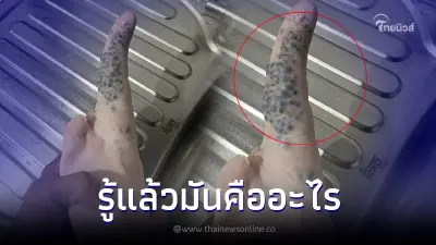 ขนลุกขนพอง หนุ่มโพสต์เจอตุ่มดำๆบนหางหมู ก่อนกูรูมาเฉลยให้