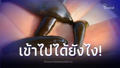 หนุ่มเจ็บคอ - เสียงแหบ ไปตรวจเจอปลิง ตกใจยิ่งกว่าเมื่อรู้ว่าเข้าไปได้ยังไง หนุ่มเจ็บคอ - เสียงแหบ ไปตรวจเจอปลิง ตกใจยิ่งกว่าเมื่อรู้ว่าเข้าไปได้ยังไง