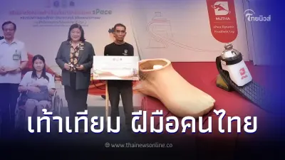 ฝีมือคนไทย! พัฒนาเท้าเทียมไดนามิก sPace เพื่อผู้พิการ ฝีมือคนไทย! พัฒนาเท้าเทียมไดนามิก sPace เพื่อผู้พิการ