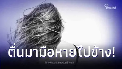 สาวตกใจใช้ไดร์เป่าผมอยู่ดีๆ ตื่นมาอีกที หมอต้องตัดมือทิ้งหนึ่งข้าง
