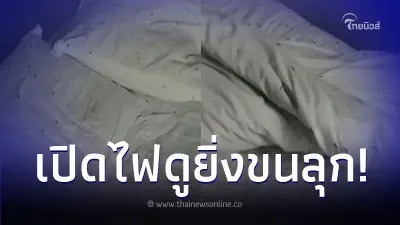 หนุ่มนอนโรงแรมดัง แต่กลางดึกรู้สึกคันไปทั้งตัว เปิดไฟดูยิ่งตกใจ