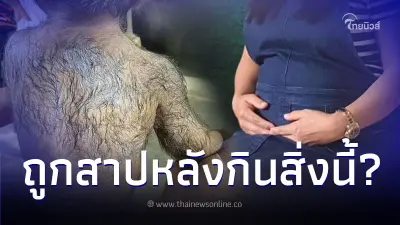 แม่ตกใจคลอดลูกออกมาขนดกผิดปกติ โทษตัวเองถูกสาปเพราะของที่กินตอนท้อง