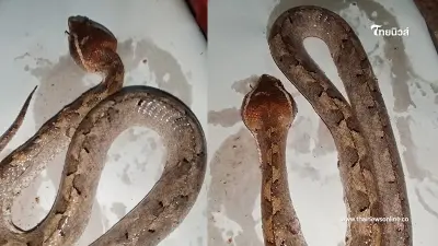 อุทาหรณ์ หนุ่ม "โดนงูกัด" แต่หมอบอกไม่มีพิษ ปล่อยกลับบ้าน หวิดถูกตัดขาทิ้ง