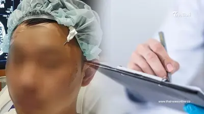 พิธีกรดัง ป่วยหลอดเลือดสมอง ทั้งที่อายุแค่ 36 ไม่ดื่ม - ไม่สูบ แต่เพราะการนอน