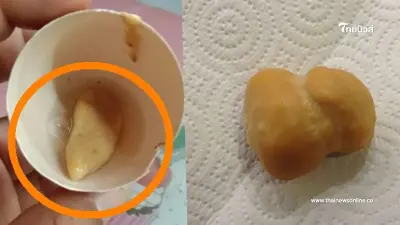 คิดว่า "ไข่ปลอม" เจอก้อนเหลืองๆแข็งๆ อย่ากิน เป็นไข่จริงแต่มันอี๋มาก