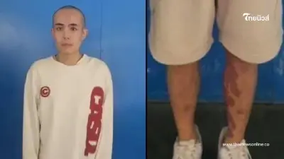 สภาพล่าสุด"ซิงซิง"แผลเต็มขา เชื่อก่อนมาไทยไม่น่ามีรอยแบบนี้ สภาพล่าสุด"ซิงซิง"แผลเต็มขา เชื่อก่อนมาไทยไม่น่ามีรอยแบบนี้