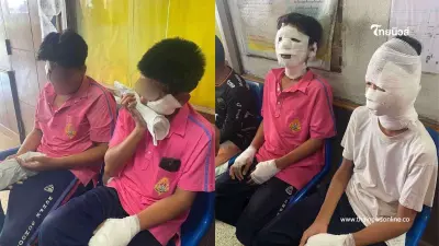 ระทึก นักเรียนยืนดูครูทดลองวิทยาศาสตร์ ไฟลุกท่วม ถูกไฟคลอกบาดเจ็บ 4 ราย