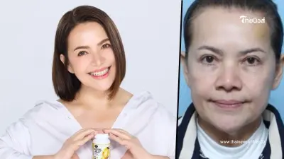 ว้าวมาก เปิดหน้าใหม่ "หนูแหม่ม สุริวิภา" ศัลยกรรมย้อนวัย สวยจนต้องขยี้ตา