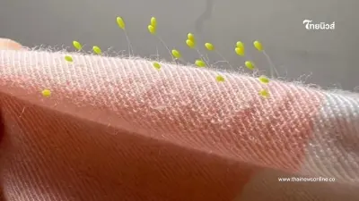 แม่ขนลุก ไข่ประหลาด บนปลอกหมอนลูก ผู้รู้มาเฉลย นำภาพตัวโตเต็มไว้มาให้ดู