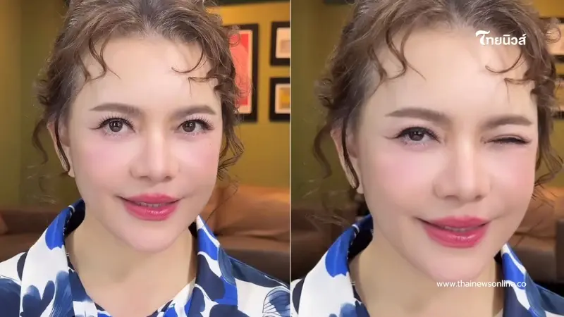 "หนูแหม่ม" อวดหน้าใหม่หลังศัลยกรรม 1 เดือน เด็กลงมาก จำแทบไม่ได้ "หนูแหม่ม" อวดหน้าใหม่หลังศัลยกรรม 1 เดือน เด็กลงมาก จำแทบไม่ได้