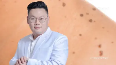 "หมอเจด" เตือนชัด 5 ลักษณะ "ไฝ" แบบไหนเสี่ยงมะเร็ง รีบสังเกตตัวเอง