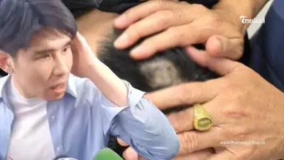 นายกเบี้ยว เปิดแผล น้องพีช ให้ดูชัดๆ หลังหันไปโวยด้วยความเจ็บปวด