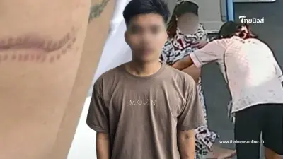 ผัวสาวท้องแก่ โชว์รอยแผลสุดน่ากลัว เย็บ 40 เข็ม ถูกเมียทำร้าย ผัวสาวท้องแก่ โชว์รอยแผลสุดน่ากลัว เย็บ 40 เข็ม ถูกเมียทำร้าย