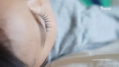 ลูกมีรอยดำแปลกๆ แถมโตเร็วผิดปกติ แม่พาไปรพ. ช้าอีกนิดส่อไม่รอด