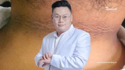ไม่อยาก "คอคาร์บอน" ทำตามด่วน หมอเจดเตือน คนผอมก็เป็นได้