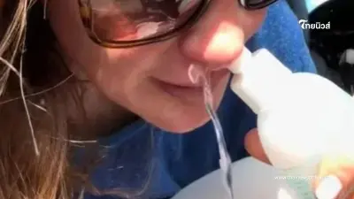 สาวป่วยไซนัสเรื้อรังนาน 7 ปี เชื่อฝังใจเพราะแฟนเก่าตดใส่หน้า