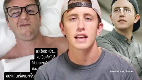 ยูทูบเบอร์ดัง "เนท My Mate Nate" ป่วยเป็นมะเร็งผิวหนัง ต้องผ่าตัด ยูทูบเบอร์ดัง "เนท My Mate Nate" ป่วยเป็นมะเร็งผิวหนัง ต้องผ่าตัด