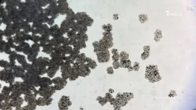 10 จังหวัดผู้ป่วย HIV ทั่วประเทศสะสมแล้วกว่า 26,000 ราย