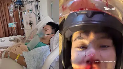 เปิดภาพ "ตั้ม เดอะสตาร์" หลังรถชนสาหัส คนดังแห่ส่งกำลังใจเพียบ