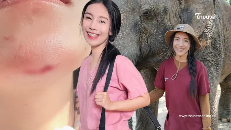 เผยอาการล่าสุด "หมอโบว์" รักษาช้าง หลังวูบหมดสติ เย็บ 5 เข็ม เผยอาการล่าสุด "หมอโบว์" รักษาช้าง หลังวูบหมดสติ เย็บ 5 เข็ม