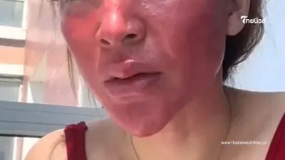 สาวไม่เคยลบเครื่องสำอาง 22 ปี แทนที่จะไปหาหมอกลับไปทำแบบนี้ สาวไม่เคยลบเครื่องสำอาง 22 ปี แทนที่จะไปหาหมอกลับไปทำแบบนี้