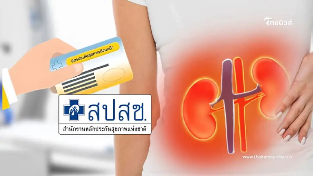 สปสช.แจงชัด  บัตรทองรักษาไตฟรี! ครอบคลุม 4 วิธี  เริ่มใช้ได้เลย